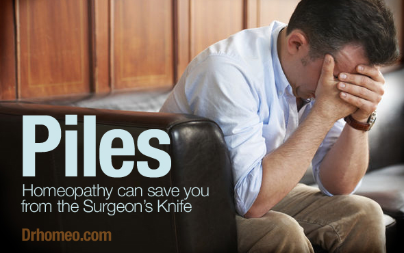 5 Best Homeopathic Medicines for Piles