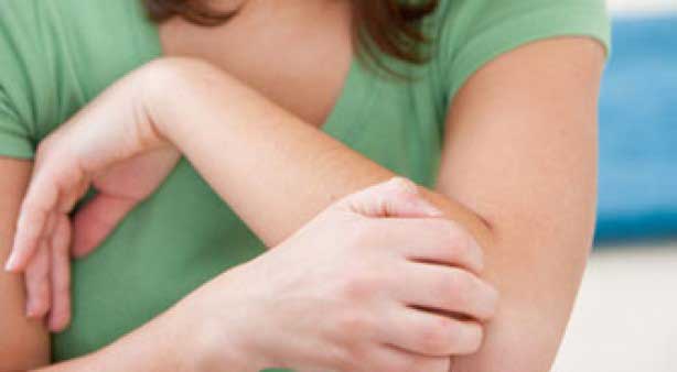 5 Best Homeopathic Medicines for Urticaria